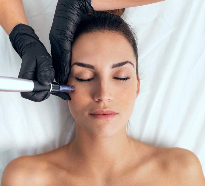 Microneedling Skin Neo Stimulation Biarritz